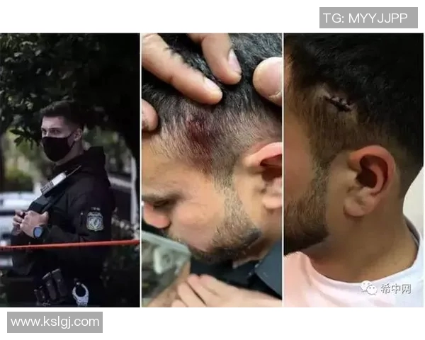 足球明星酒馆遭枪杀事件引发社会关注与安全讨论